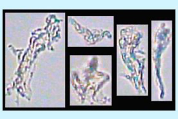 Flowcam_proteineAggregate