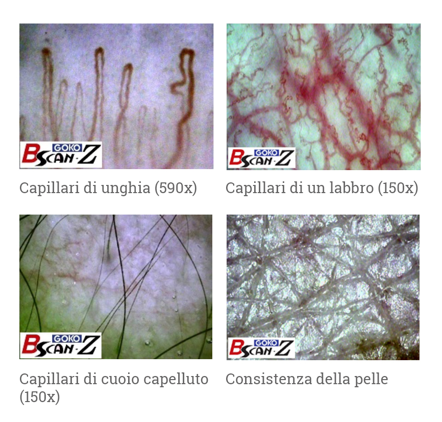 Goko immagini di esempio Goko immagini di esempio