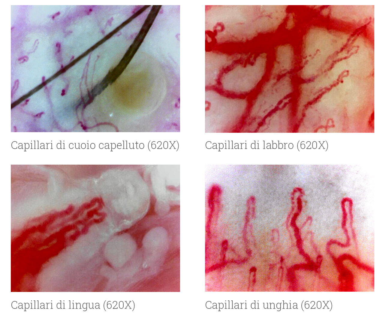 Immagini di esempio GOKO Immagini di esempio GOKO